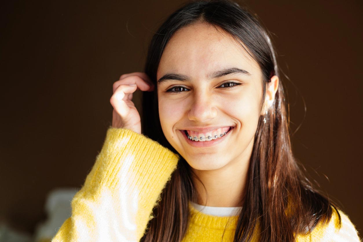 Braces Treatment Time by Type