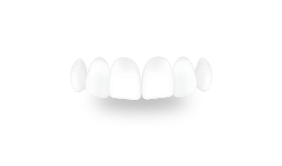 level one teeth image