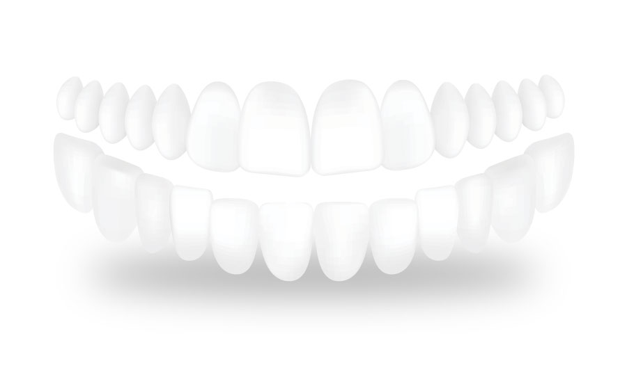 level three teeth image