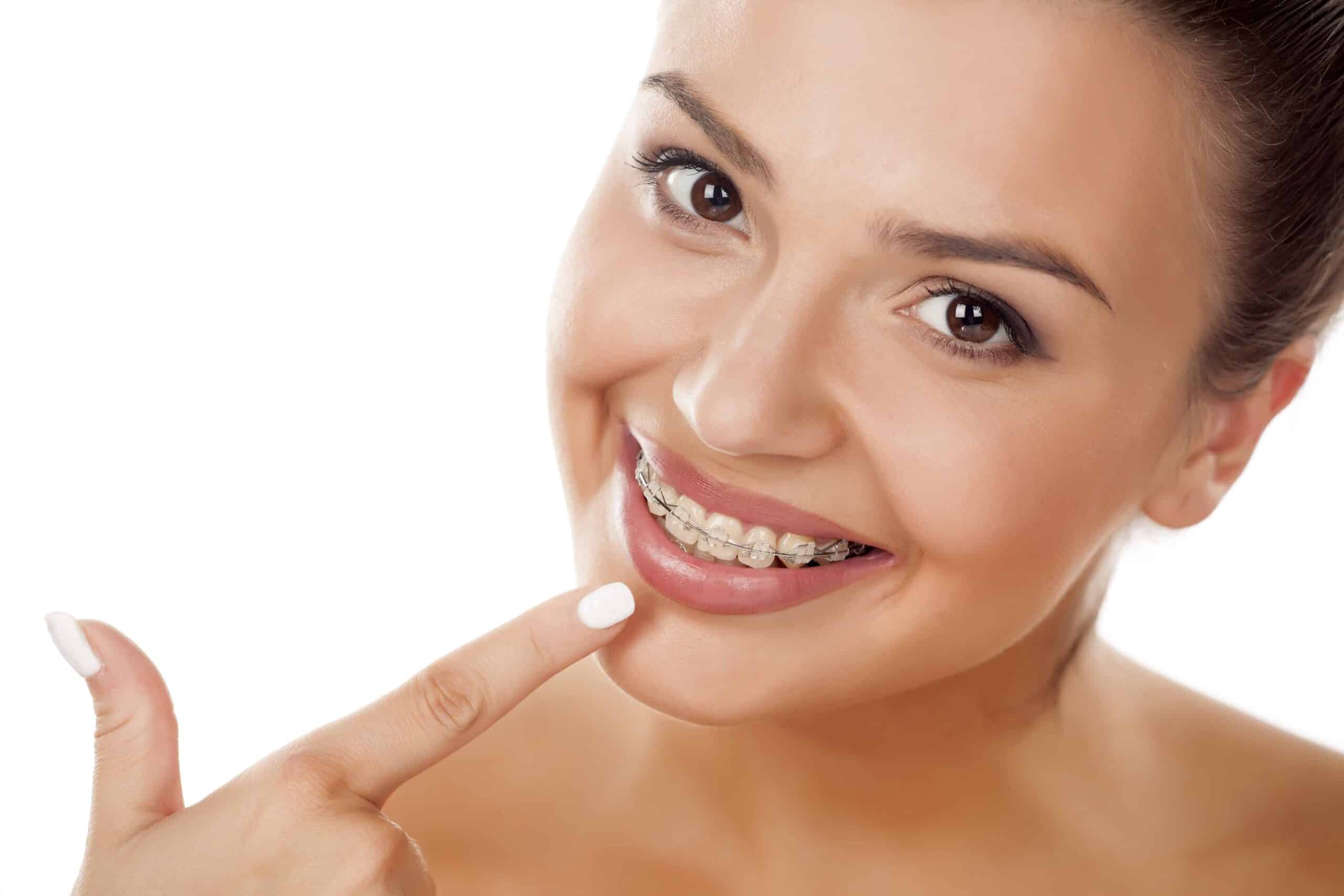 smiling young woman pointing a finger on her braces