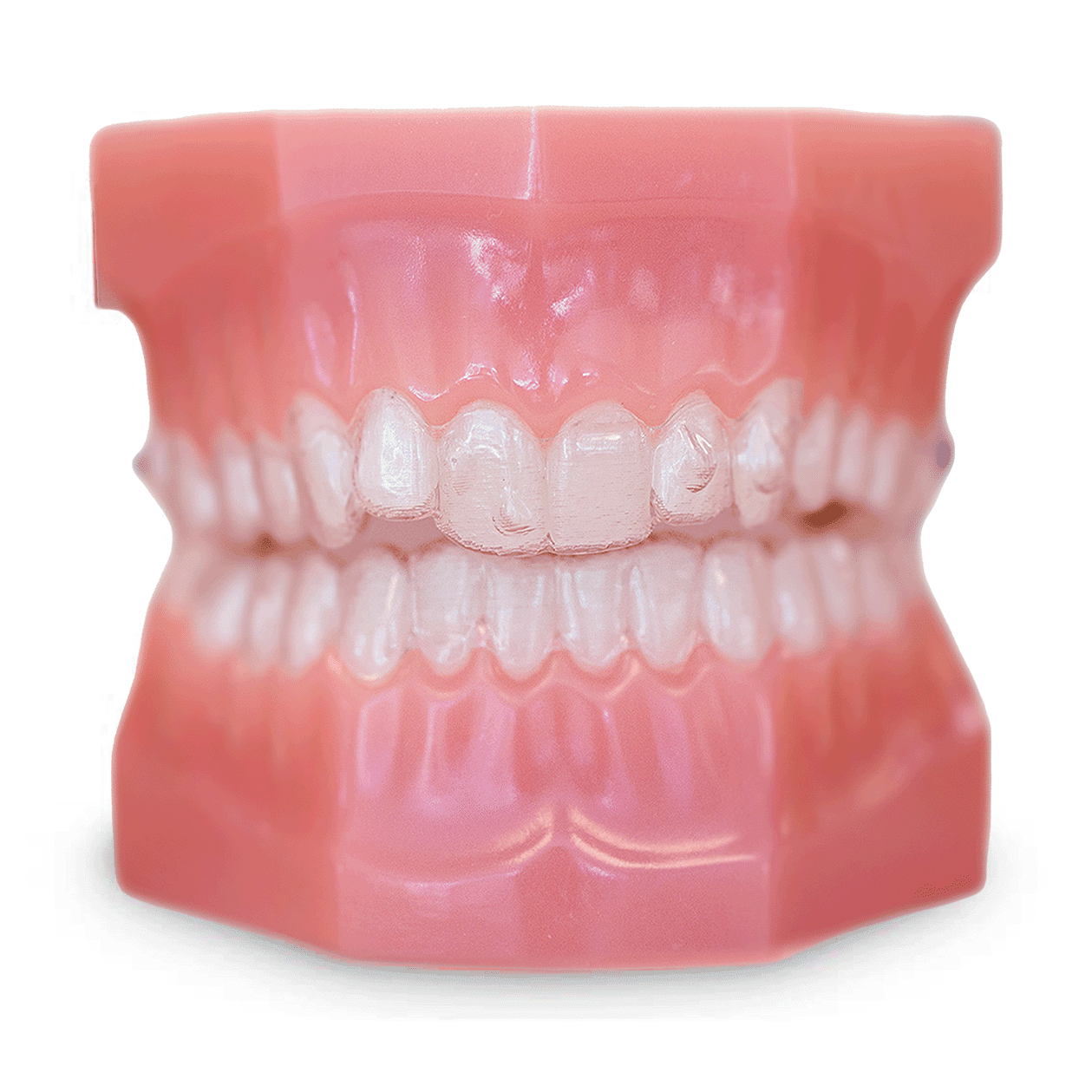 Clear-Aligners