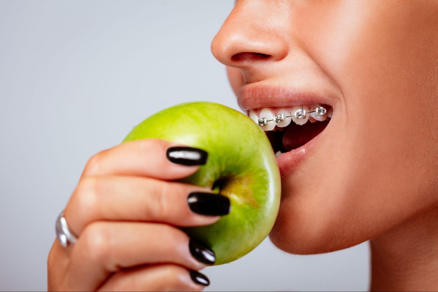 braces fresno