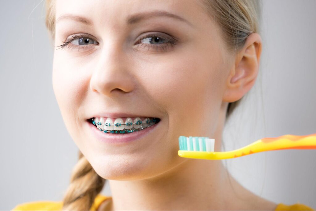 How to Care for Your Braces