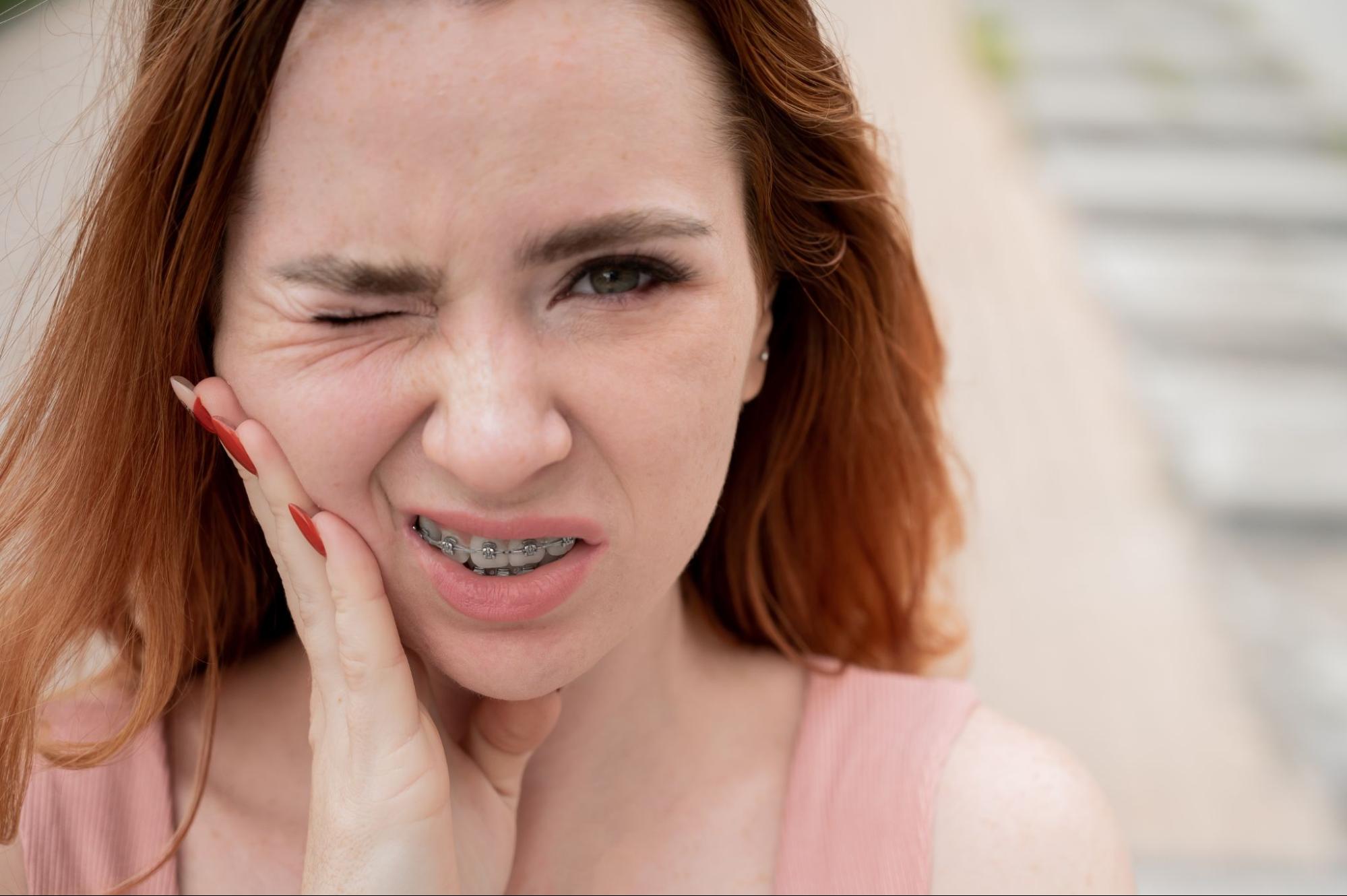 How to Deal with Orthodontic Emergencies