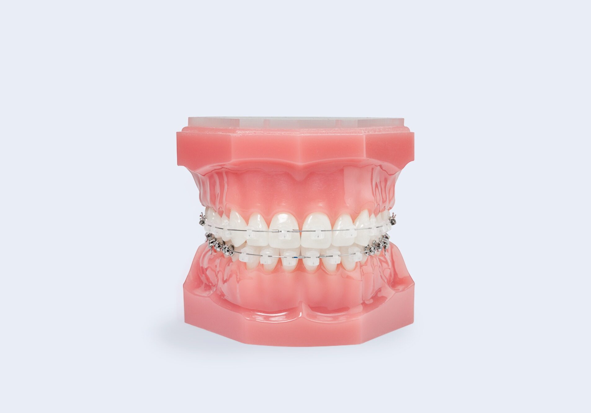 Damon-Clear braces fresno