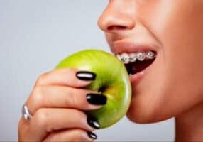 5 Foods to Avoid with Braces in Fresno, CA