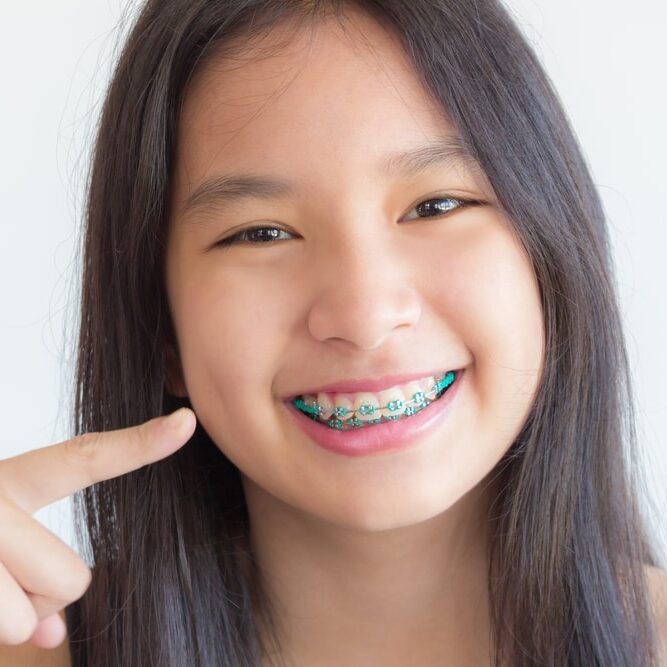 Asian,Girl,Smile,And,Point,At,Her,Teeth,,,She